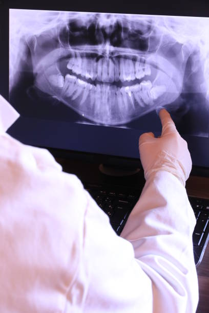 Best Root Canal Emergency Dentist  in Bunkie, LA