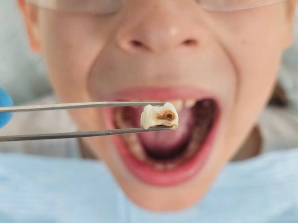 Best Emergency Gum Pain Relief  in Bunkie, LA